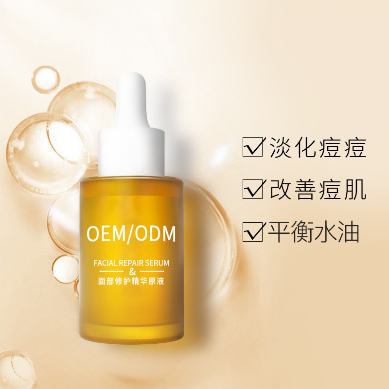 朝阳区_祛痘精华原液OEM